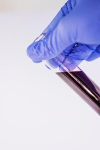 医療脱毛のトライアルはどのような内容なのか？
