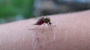 VIO脱毛で痛みが少ないとされる肌トラブルの事例とは？